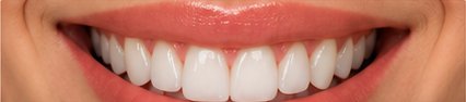 Smile after treatment