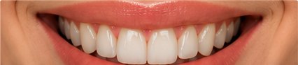 Smile before treatment