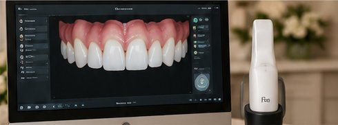 Smile design software
