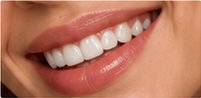 Whitened smile close-up