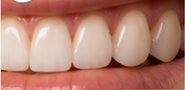 Finished natural-looking teeth