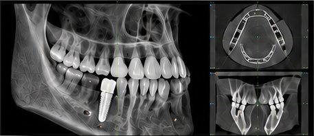 CBCT 3D scan views