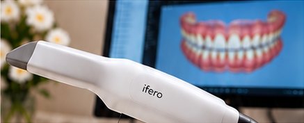 iTero intraoral scanner