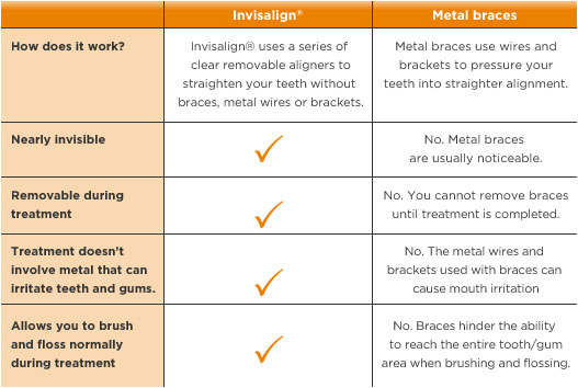 Invisalign Jersey City Chart